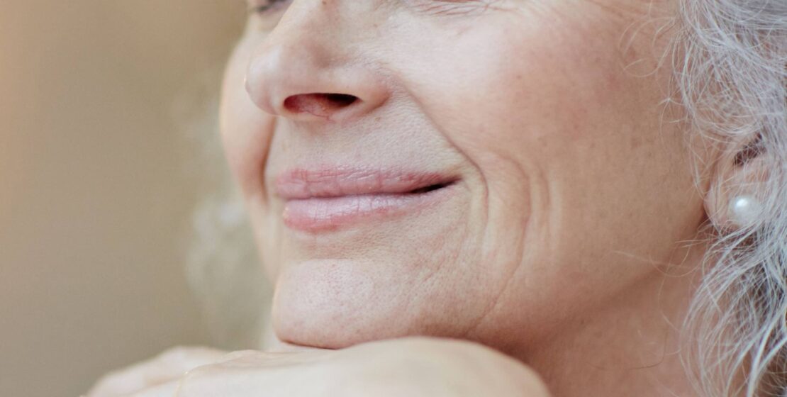 Couperose et rougeurs